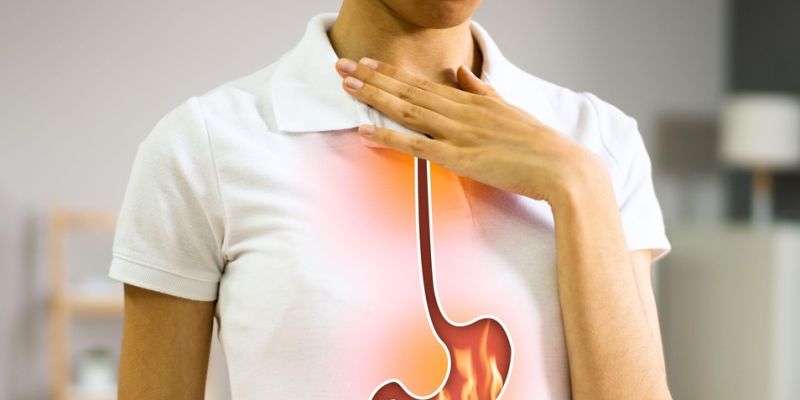 refluks, zgaga, gerb