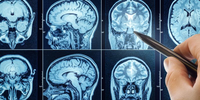 nespecnost, spanje, tezave