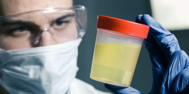 test urina, vzorec urina