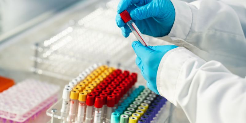 krvna slika izvid.jpg