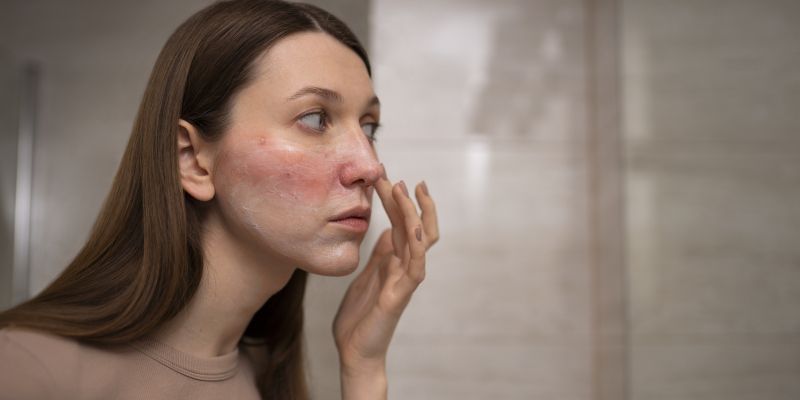 Obnova kožne bariere.jpg