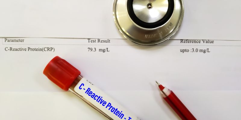 povišan CRP v krvi.jpg