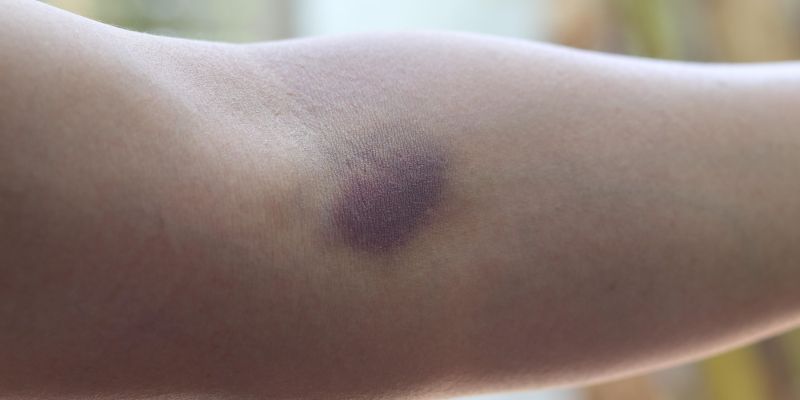 modrica, odvzem krvi