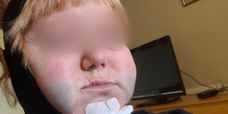 liposukcija2a.jpg