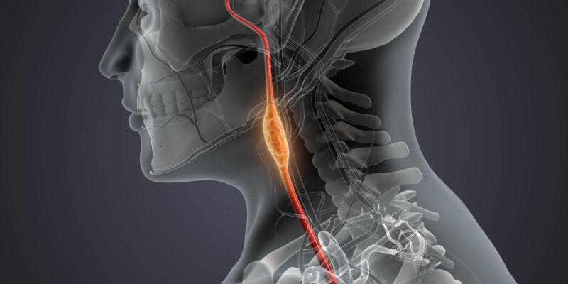 tumor4.jpg