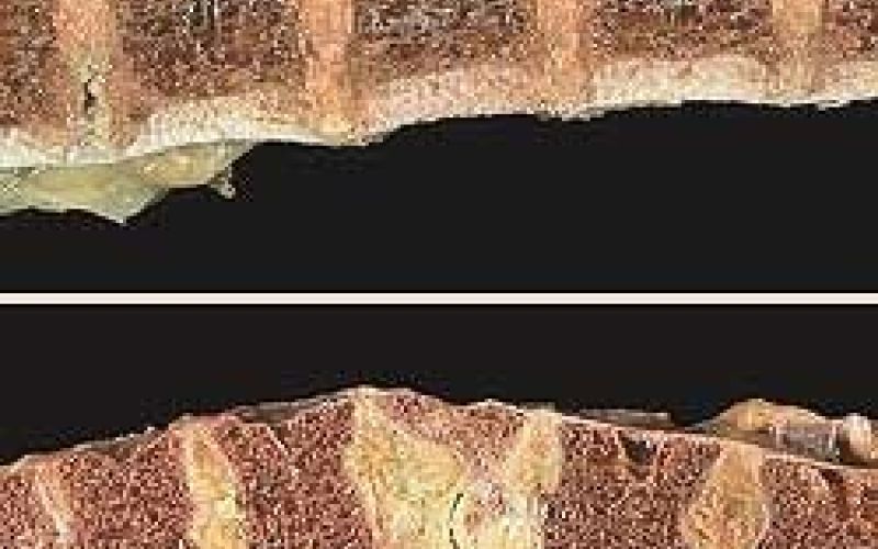 osteoporoza.jpg