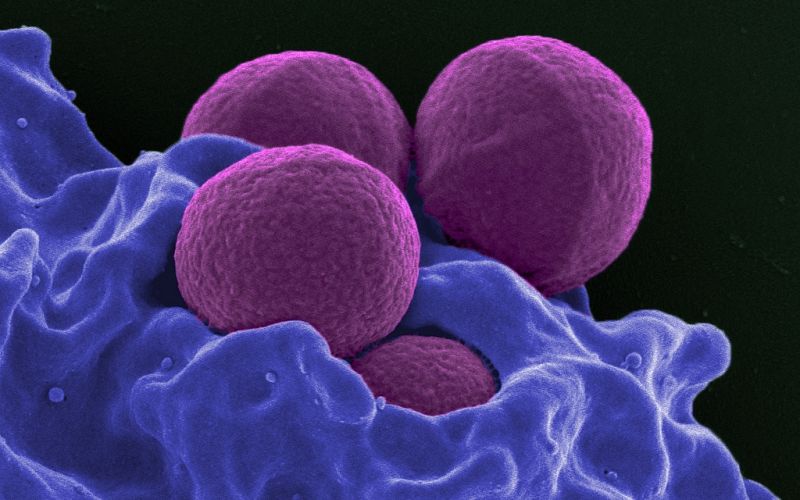 MRSA bakterija