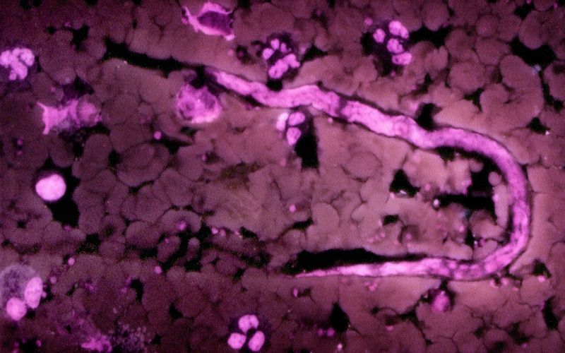 Onchocerca volvulus