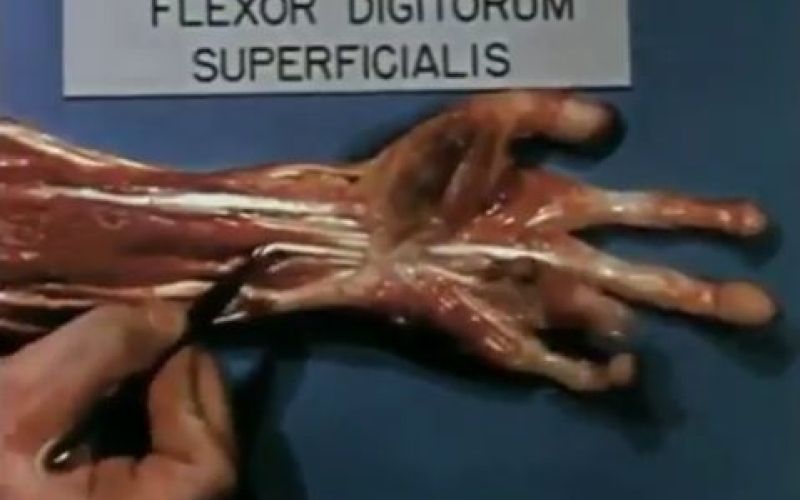 flexor digitorum superficialis.jpg