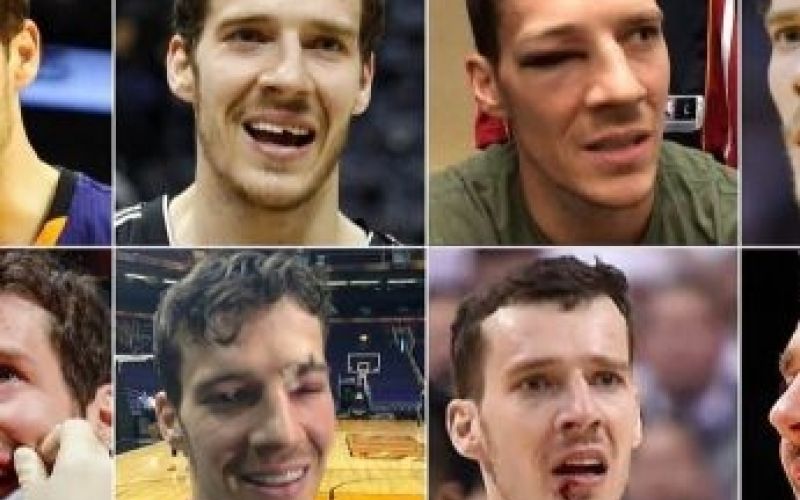 Poškodbe Goran Dragić