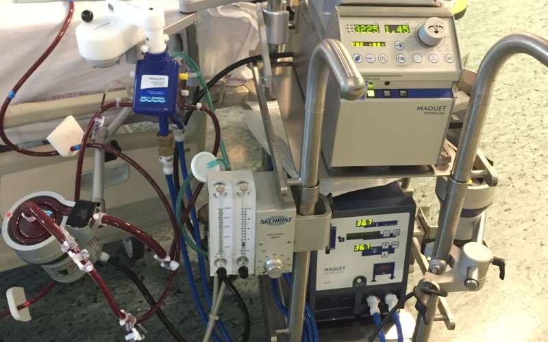 ecmo aparat1.jpg