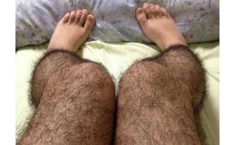 Hairy_legs.jpg