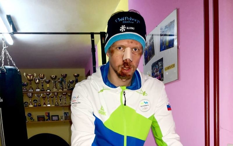 Klemen Kosi