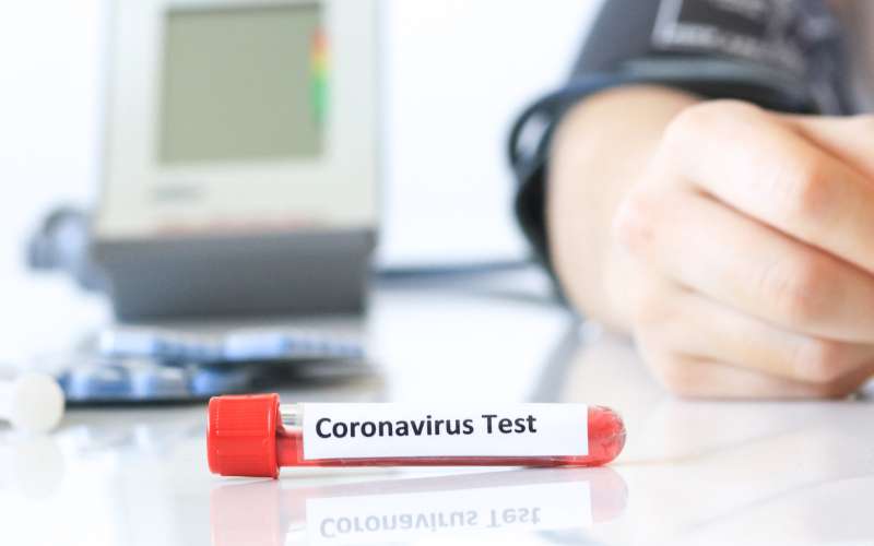 koronavirus, zdravstvo, epidemija