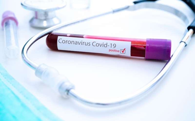 koronavirus covid-19