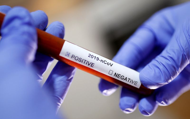 coronavirus-epruvete.jpg