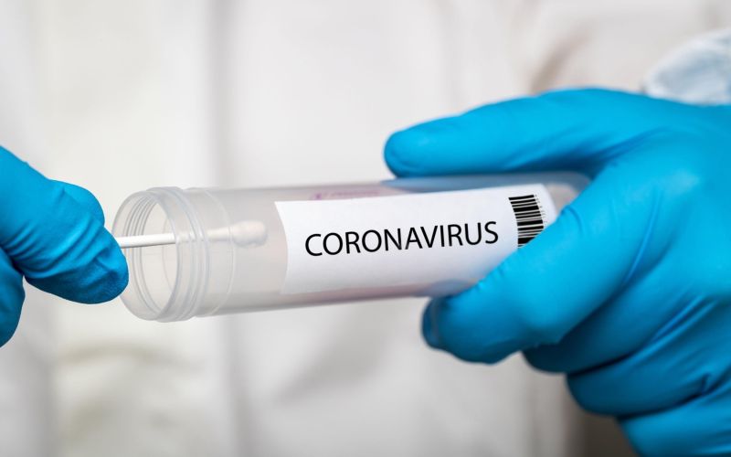 koronavirus, test