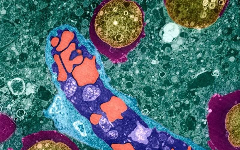 primarni amebni meningoencefalitis, naegleria fowleri
