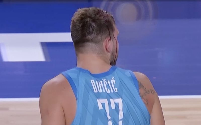 doncic krvav.jpg