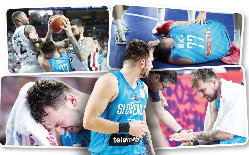 doncic poskodba.jpg