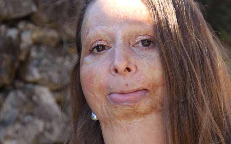 katja-škerlj