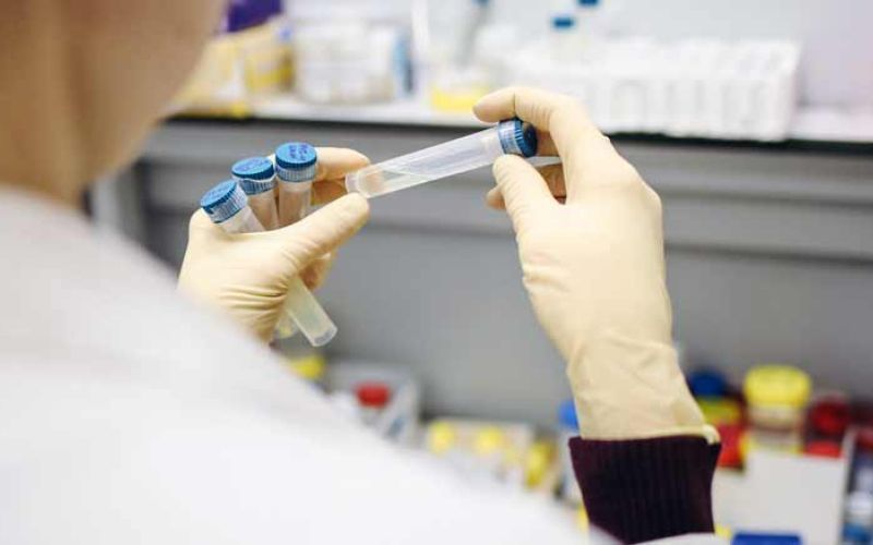 covid-gripa-test-zdravnik