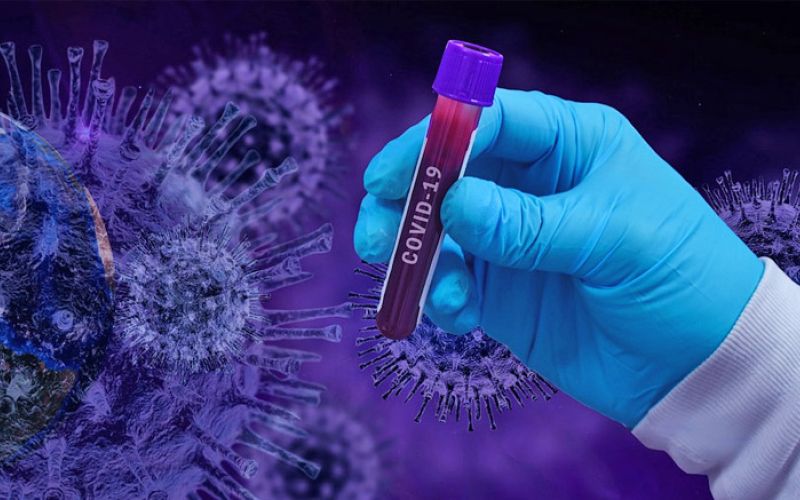 covid-19-korona-laboratorij-kri