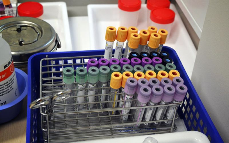 laboratorij, bolezen, zdravstvo, bolnica, zdravnik, kri