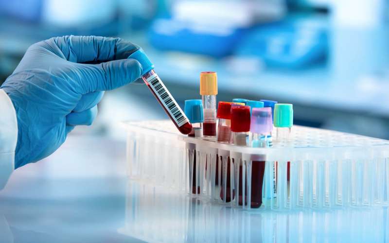 krvni test