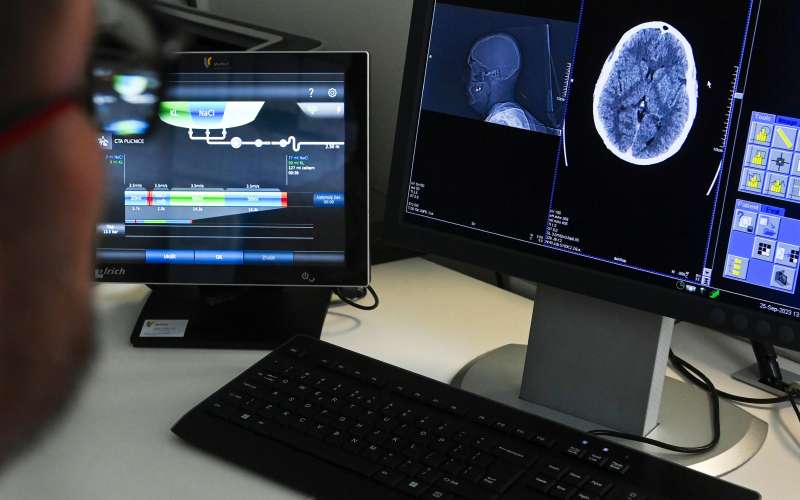 izvid, zdravnik, radiologija,