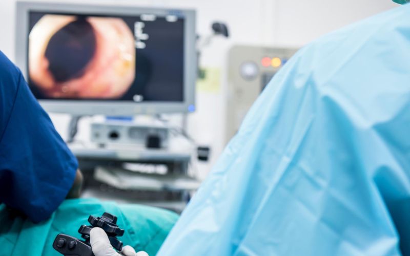 zdravje kolonoskopija2ali.jpg