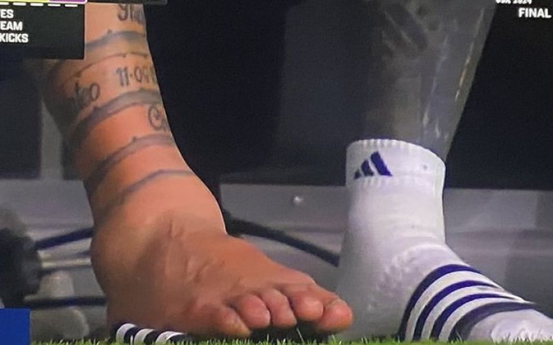messi gleženj 1.jpg