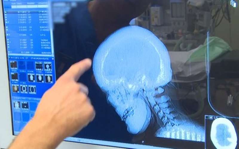 skull-surgery-simbolična.jpg