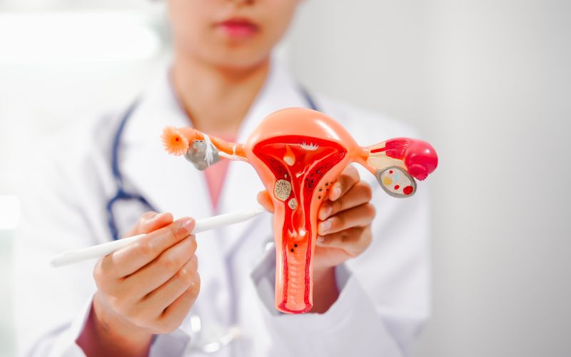 Endometrioza.jpg