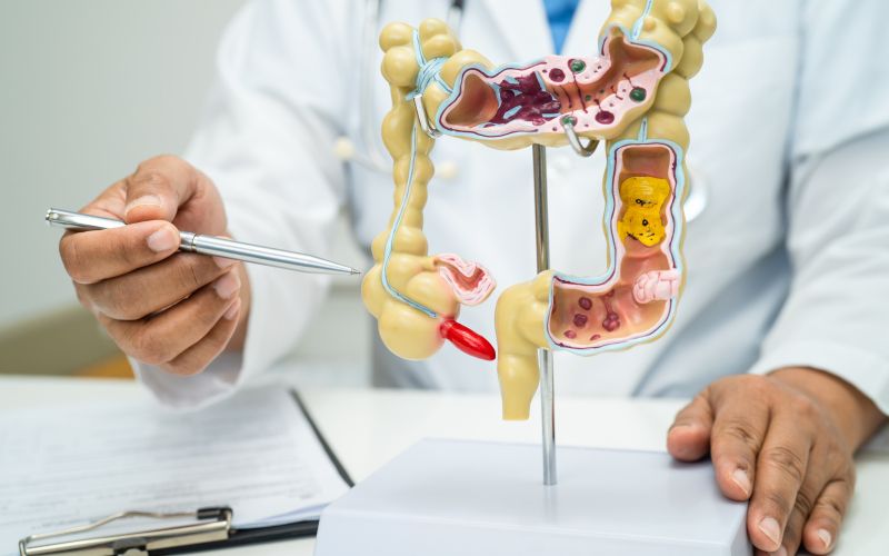 slepič, slepo črevo