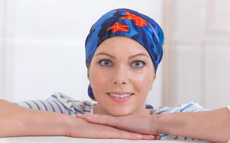 kemoterapija, izguba las