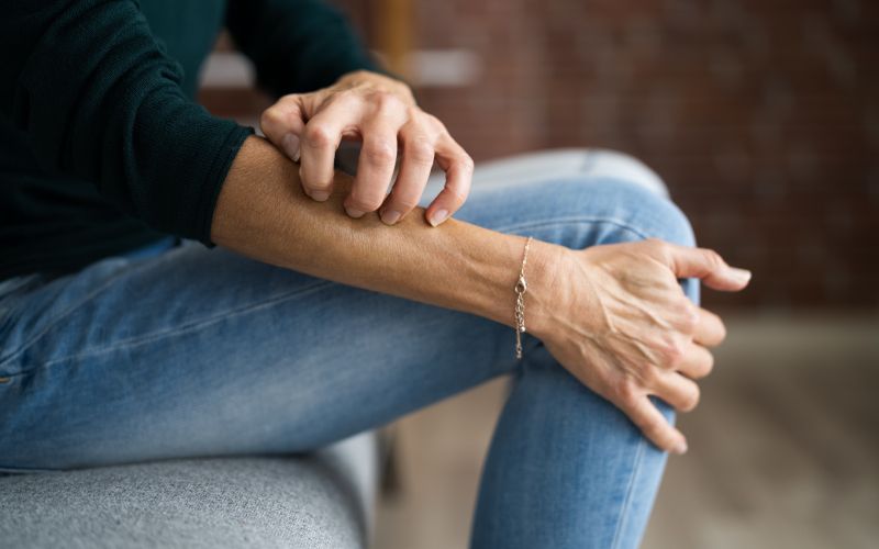 suha koža, srbenje, srbečica