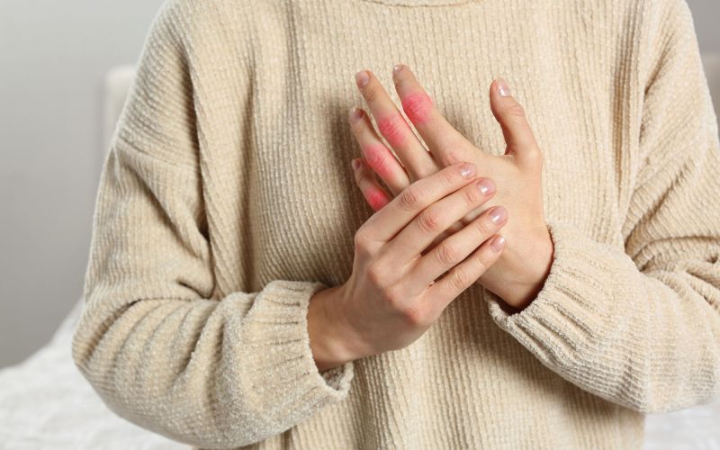 zdravje artritis (1).jpg