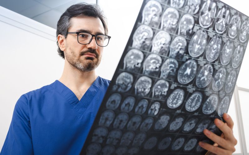 možgani, zdravnik, tumor