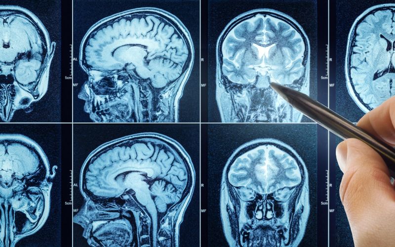 nespecnost, spanje, tezave