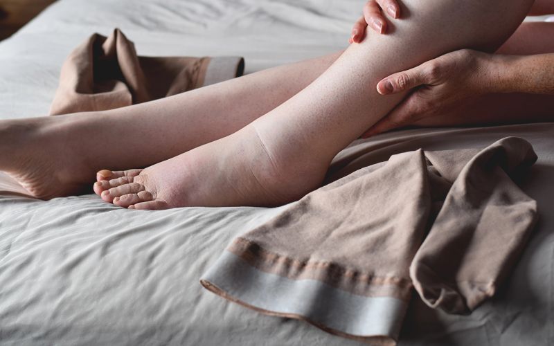 OTEKANJE NOG, OTEČENE NOGE, STOPALA, GLEŽNJI