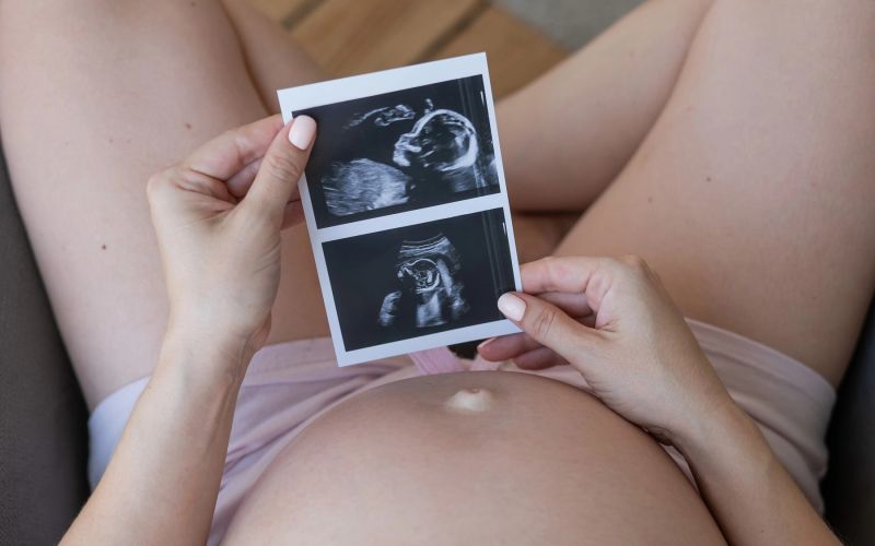 nosečnost, ultrazvok, slika