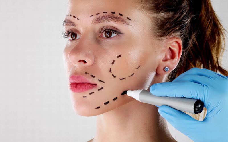 Lepotni poseg, operacija, botoks, mladi