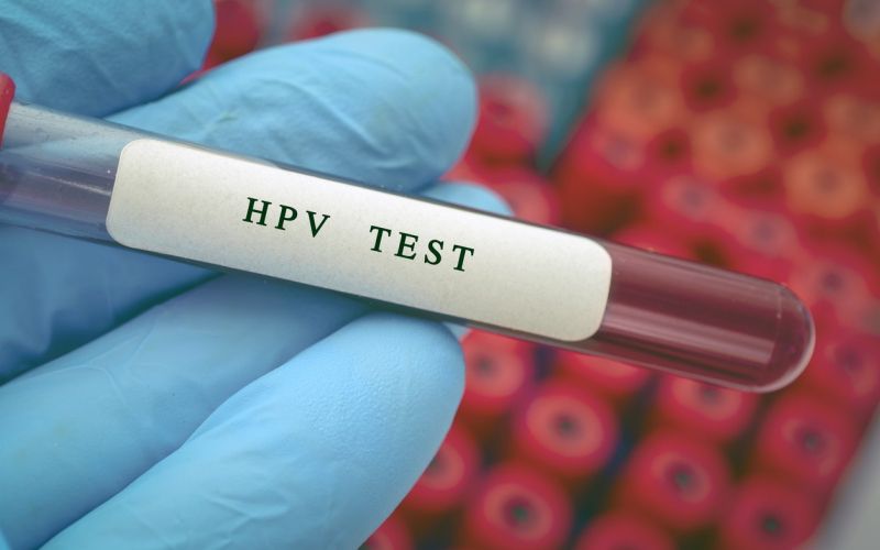 hpv test.jpg
