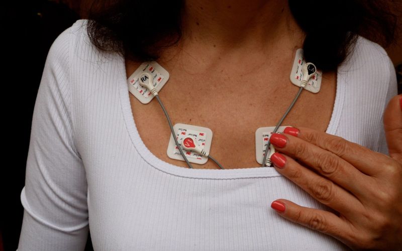 bolezni srca in ožilja.jpg