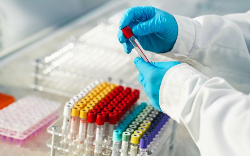 krvna slika izvid.jpg