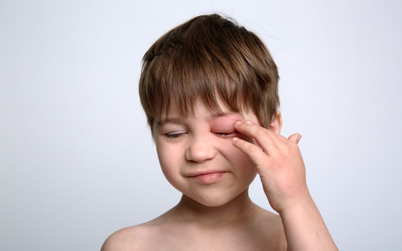 vneto oko pri otrocih.jpg