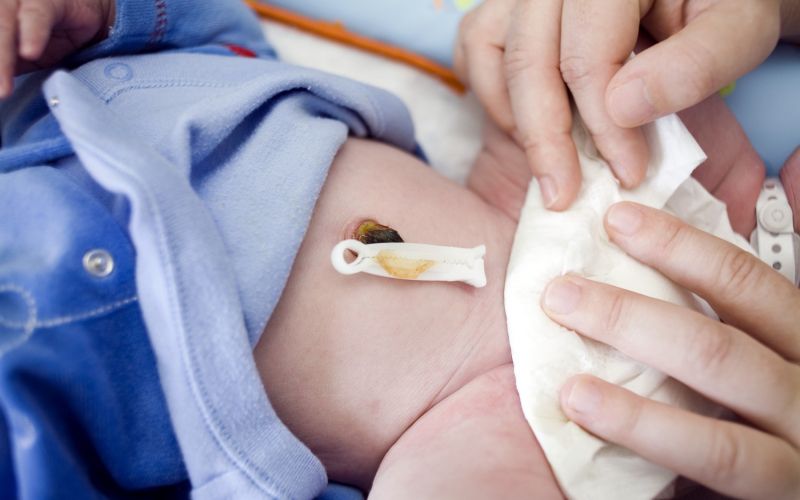 popek, novorojenček