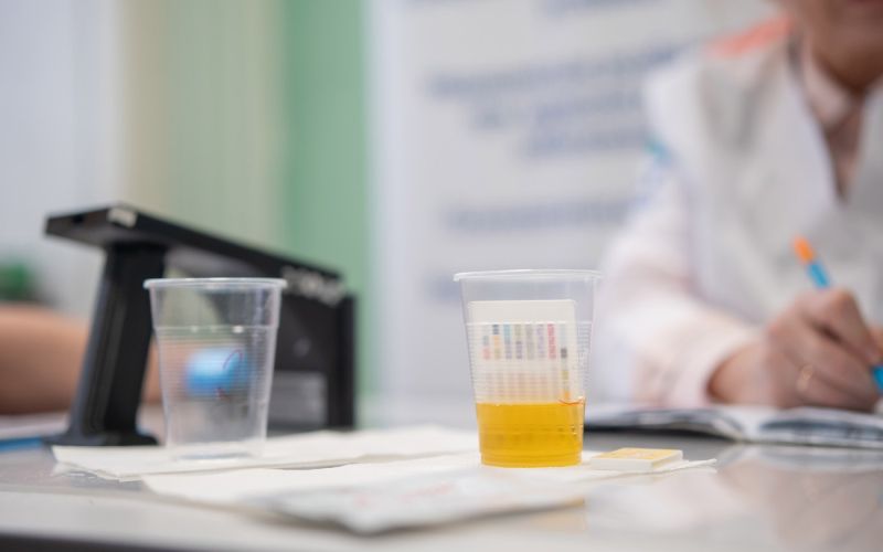 test, lonček, urin.jpg