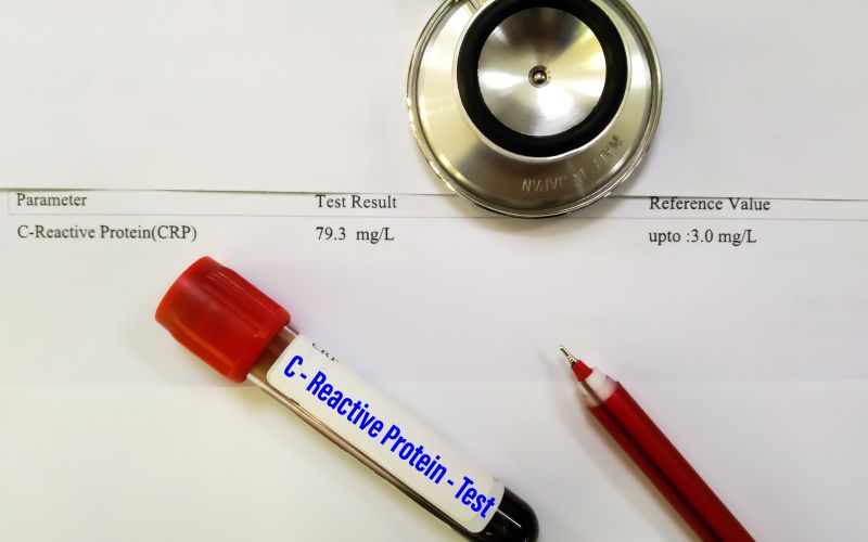 povišan CRP v krvi.jpg